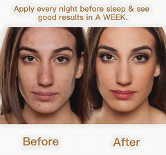 4K Plus Whitening Night Cream 5X Goji Berry – 20g