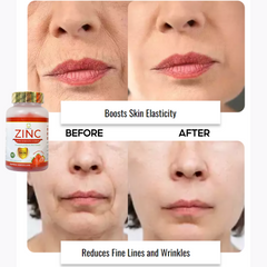 Dr. Pinoca Zinc Extra Strength Gummies