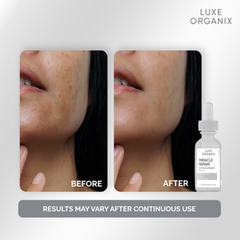 Luxe Organix Miracle Repair Luminous Bright Face Serum - 30ml