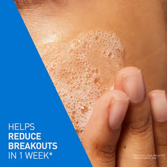 CeraVe Blemish Control Cleanser – 236ml