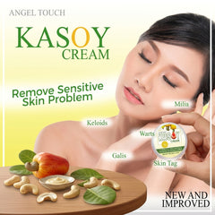 Kasoy Cream Warts Remover Angel Touch - 5g