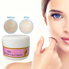 Skinlite Brightening Cream - 50g