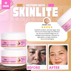 Skinlite Brightening Cream - 50g