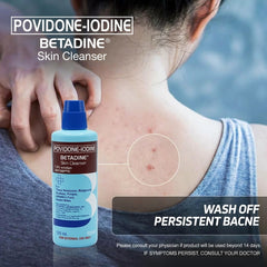 Betadine Povidone-Iodine Skin Cleanser 7.5% Solution – 120ml