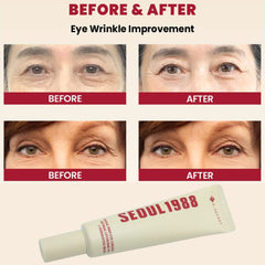 K-SECRET SEOUL 1988 Eye Cream – Retinal Liposome 4% + Fermented Bean – 30ml