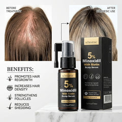 KORMESIC 5% Minoxidil with Biotin Scalp Serum – 30ml