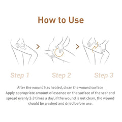 LANBENA Skin Care Gel – Acne Scar & Mark Removal (30ml)