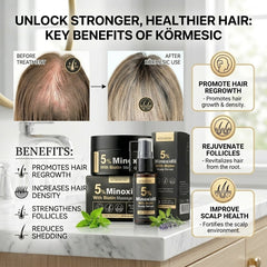 KORMESIC Minoxidil Hair Growth Combo