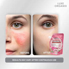 Luxe Organix Rosewater Soothing Gel with Whitening Pearls – 100ml