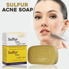 Skin Doctor Sulfur Soap - 80g - Pinoyhyper