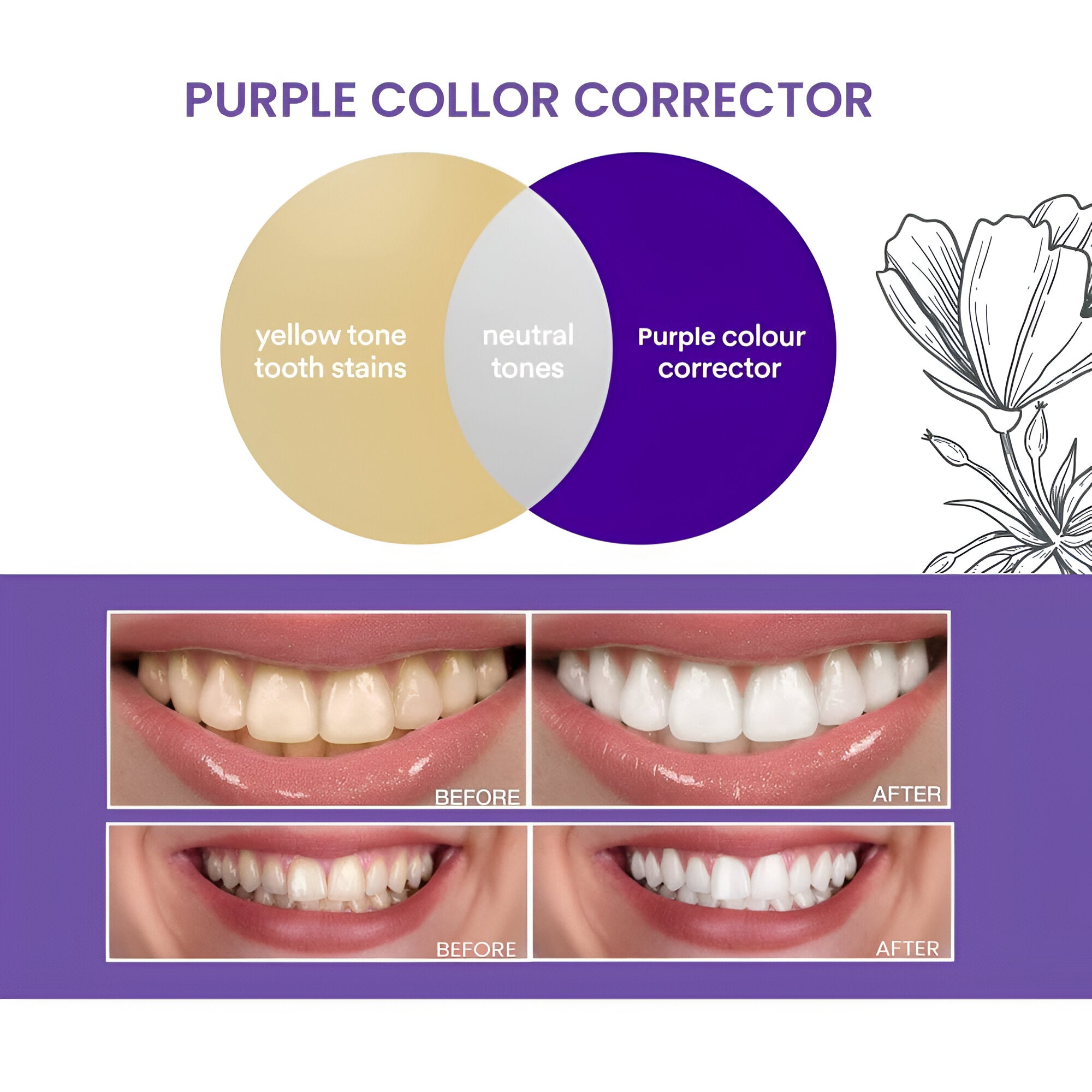 Scoban Tooth Powder Scoban Purple Tooth Whitening Powder - 30g – Sige Mart UAE