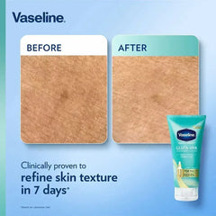 Vaseline Gluta-Hya Serum Burst Lotion Smoothing Perfector – 290ml