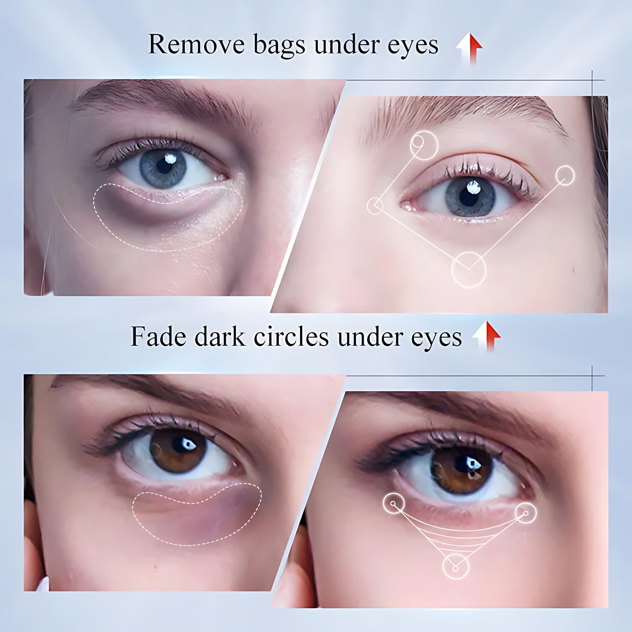 Sadoer Kojic Acid Whitening Freckles Eye Cream – 20g