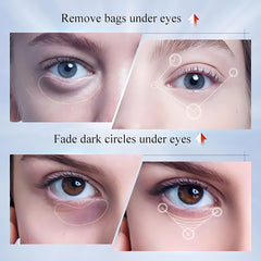 Sadoer Kojic Acid Whitening Freckles Eye Cream – 20g