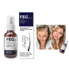FEG Plus Hair Growth Spray – 50ml
