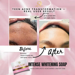 MEG SKIN Intense Whitening Soap – 150g (BUY 1 GET 1 OFFER)