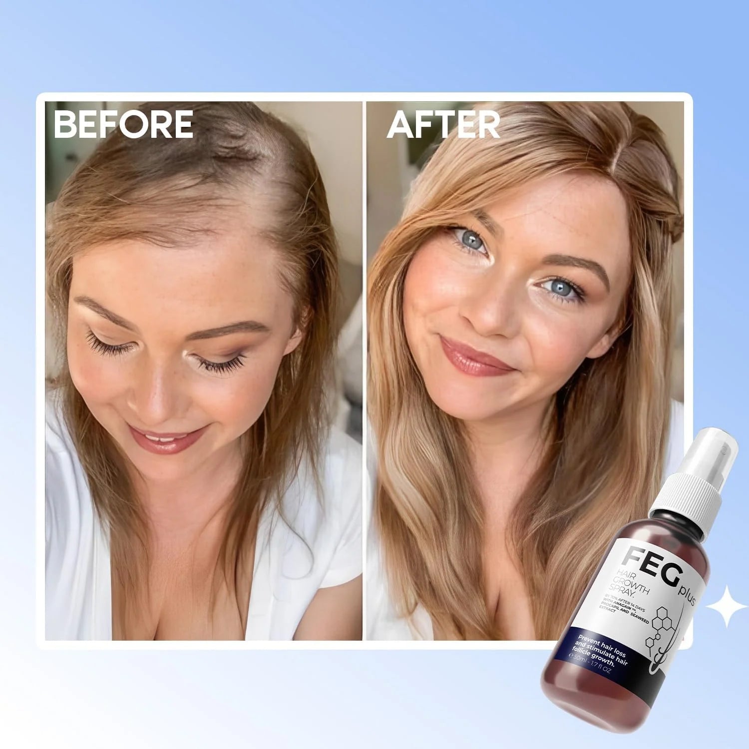 FEG Plus Hair Growth Spray – 50ml