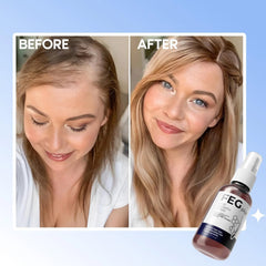 FEG Plus Hair Growth Spray – 50ml