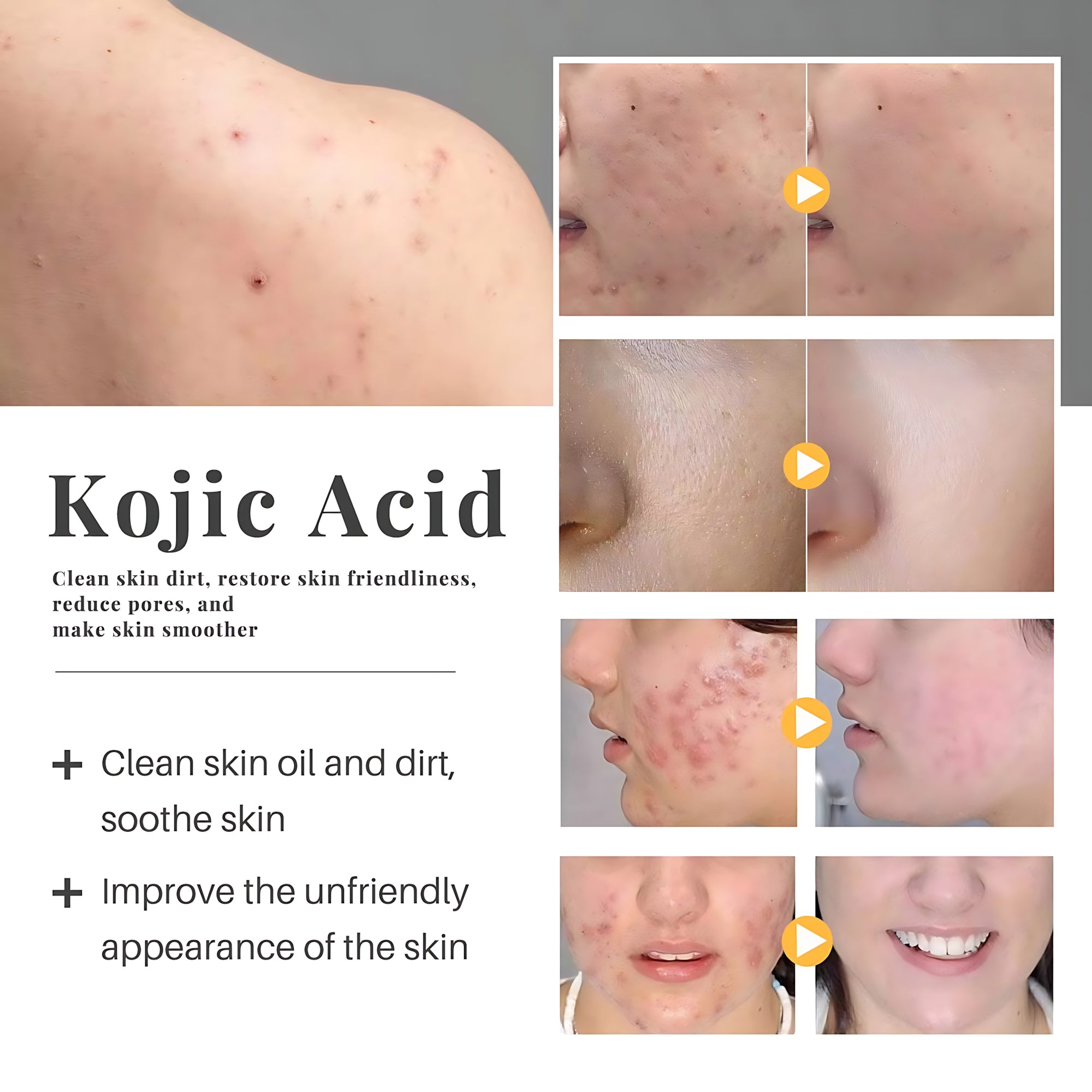 K88 Kojic Niacinamide Soap – Skin Brightening & Even-Tone Formula (70g)