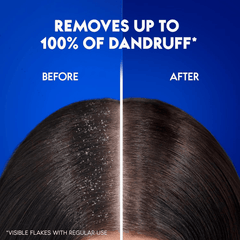 Head & Shoulders Daily Clean Anti Dandruff Shampoo - 400ml