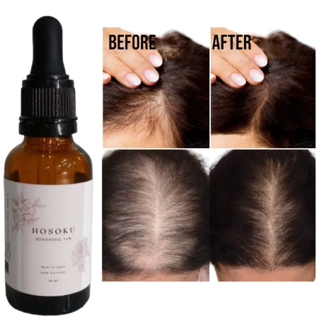 HOSOKU Hair Growth Serum - 30ml