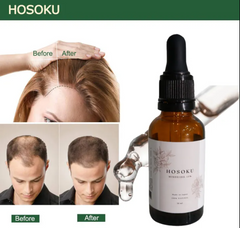 HOSOKU Hair Growth Serum - 30ml