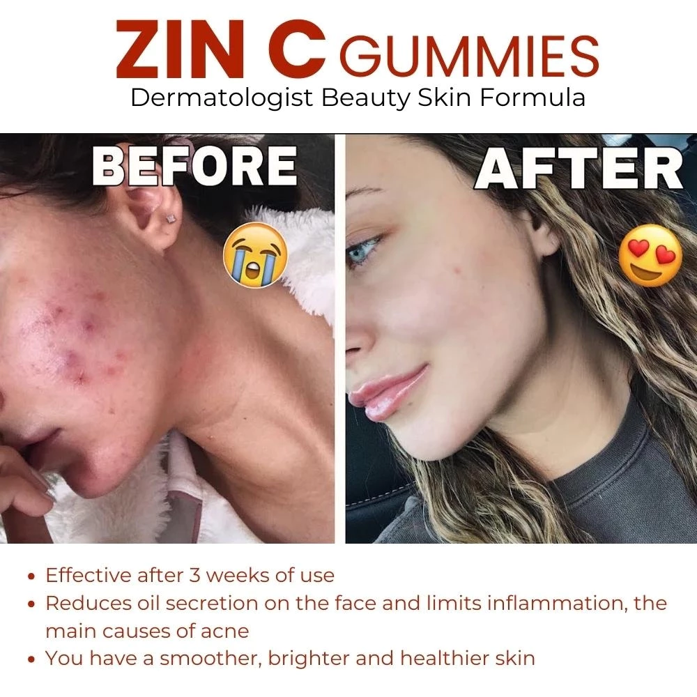 Dr. Pinoca Zinc Extra Strength Gummies