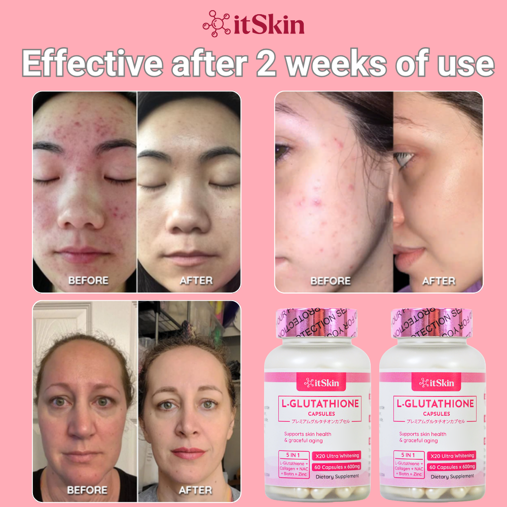 It Skin L-Glutathione Sige Mart UAE It Skin L-Glutathione Sige Mart UAE