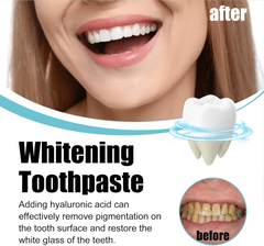 Scoban Teeth Whitening Toothpaste With Baking Soda - 200g