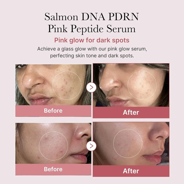 Medicube PDRN Pink Peptide Serum - 30ml