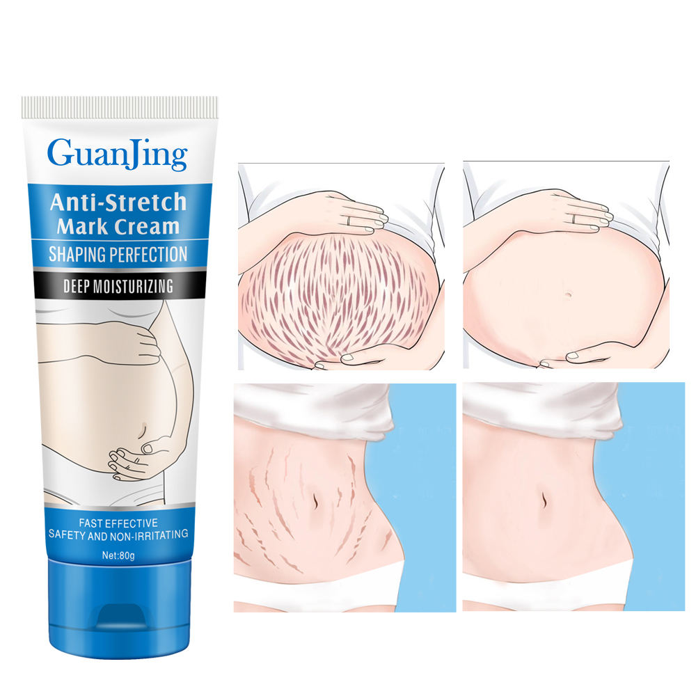 Guanjing Anti-Stretch Mark Cream Shaping Perfection  - 80g