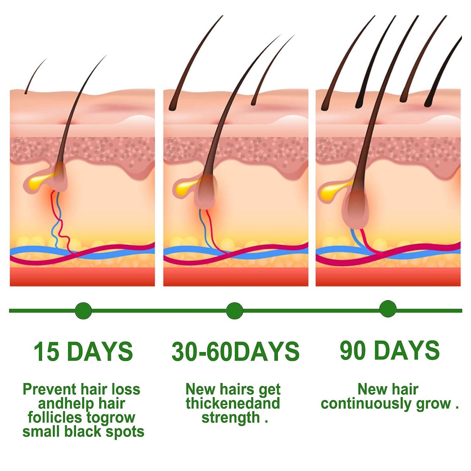EELHOE Rosemary Oil for Hair Growth - Pinoyhyper