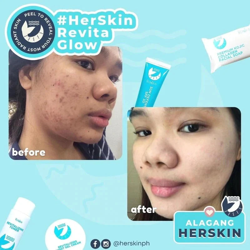 Herskin Revita-Glow Skin Rescue - Pinoyhyper