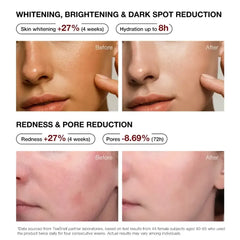Teashell 5% Niacinamide Brightening Serum – 30ml