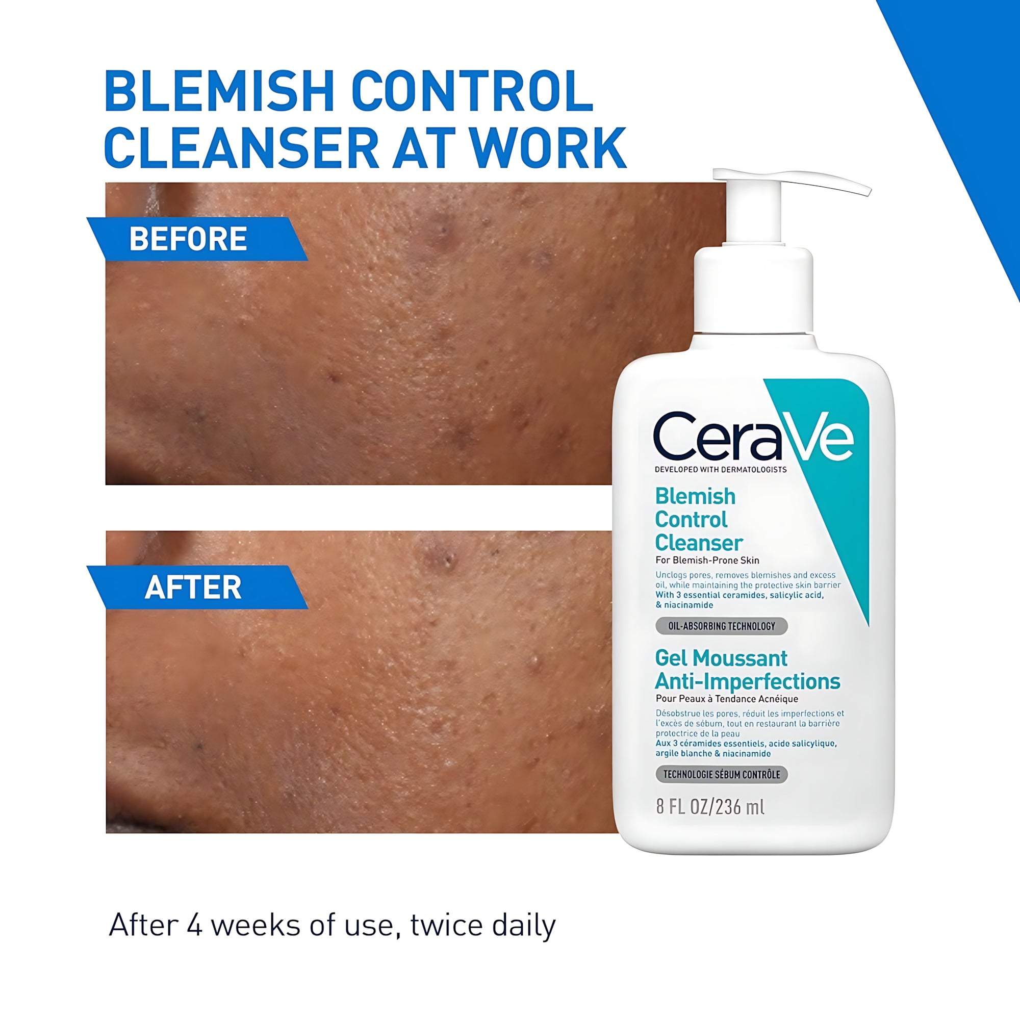 CeraVe Blemish Control Cleanser – 236ml