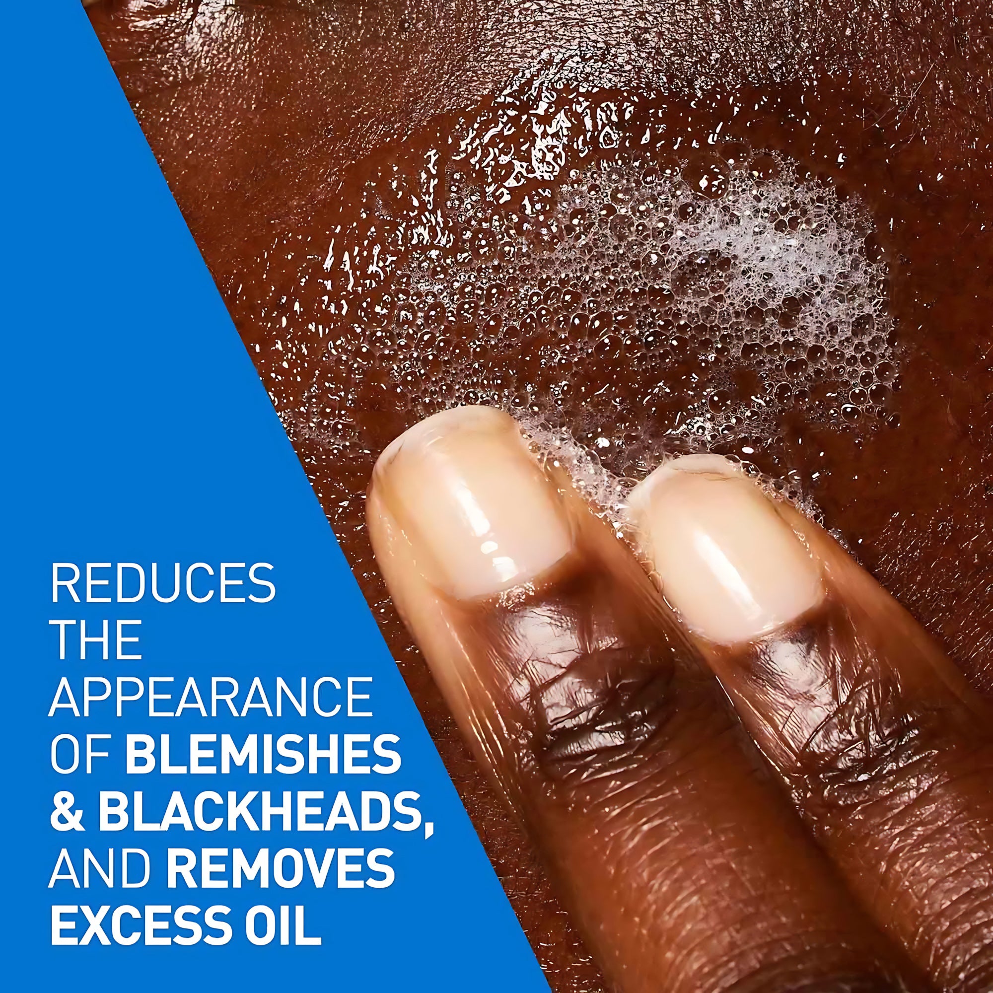 CeraVe Blemish Control Cleanser – 236ml