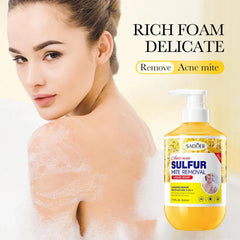 SADOER Anti-Acne Sulfur Mite Removal Liquid Soap – 500ml