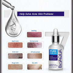 BIOAQUA Acne Removing Skin Rejuvenating Essence - 30ml