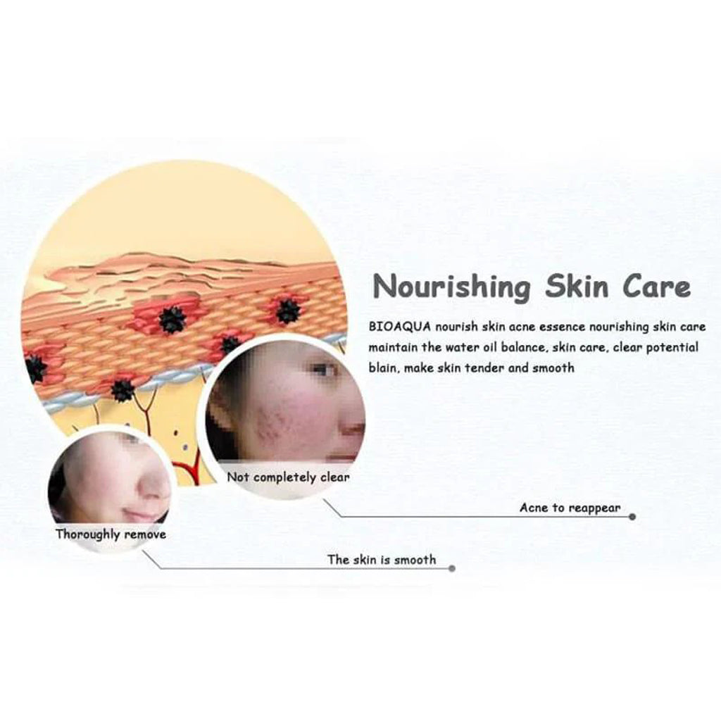 BIOAQUA Acne Removing Skin Rejuvenating Essence - 30ml