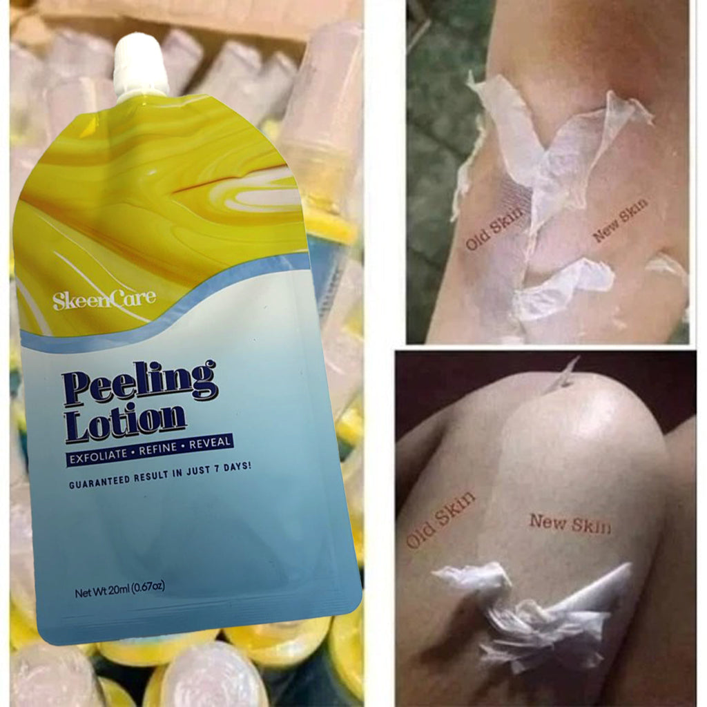SkeenCare Peeling Lotion - 20ml Sachet