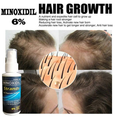 Minoxidil Strands 6% Hair Regrowth Treatment - 60ml