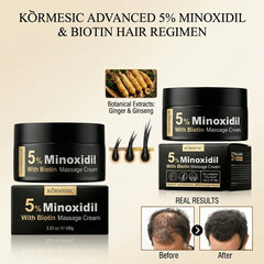 KORMESIC 5% Minoxidil with Biotin Scalp Massage Cream – 100g