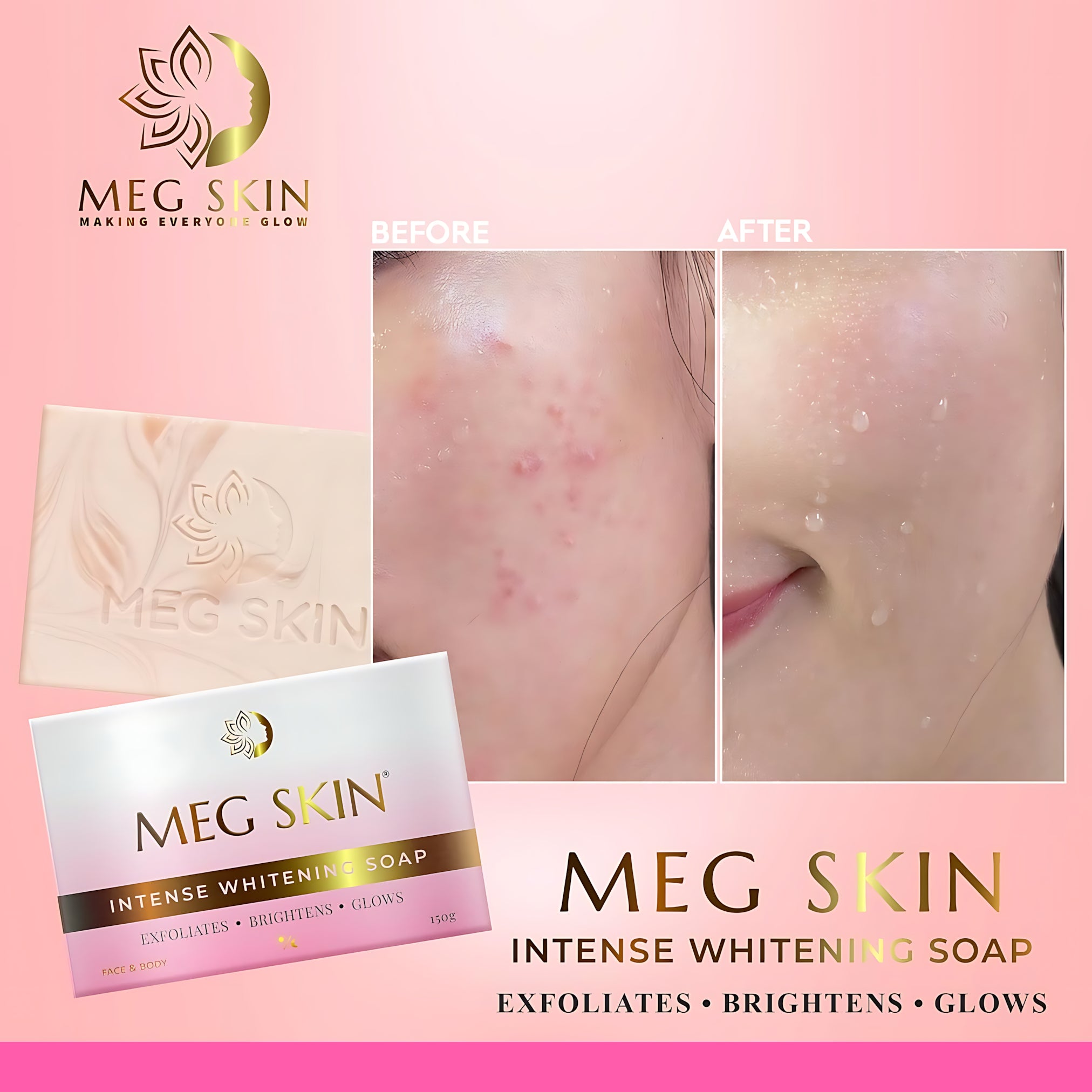 MEG SKIN Intense Whitening Soap – 150g