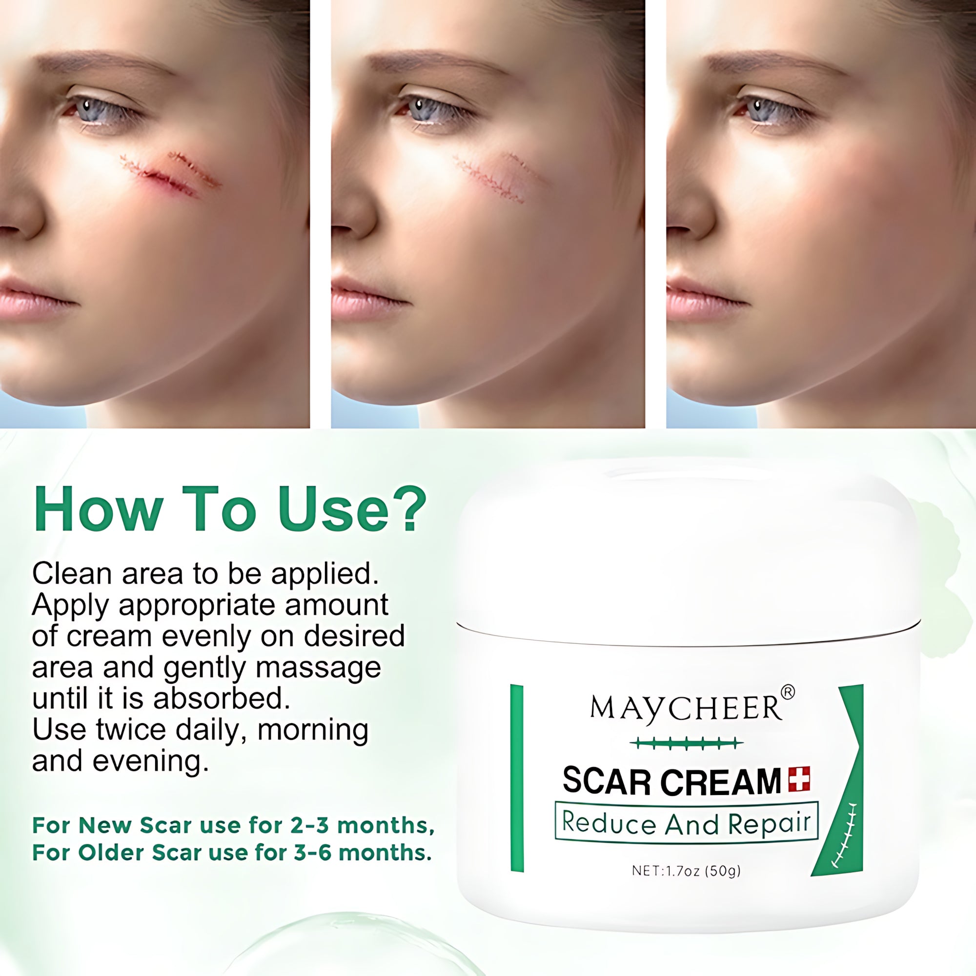MAYCHEER Scar Cream – Advanced Scar Reduction & Skin Repair (50g)