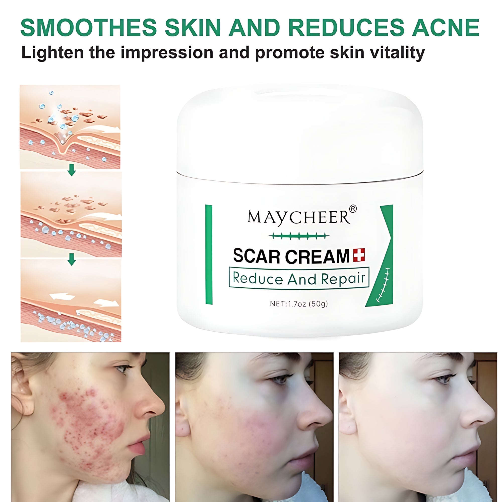 MAYCHEER Scar Cream – Advanced Scar Reduction & Skin Repair (50g)