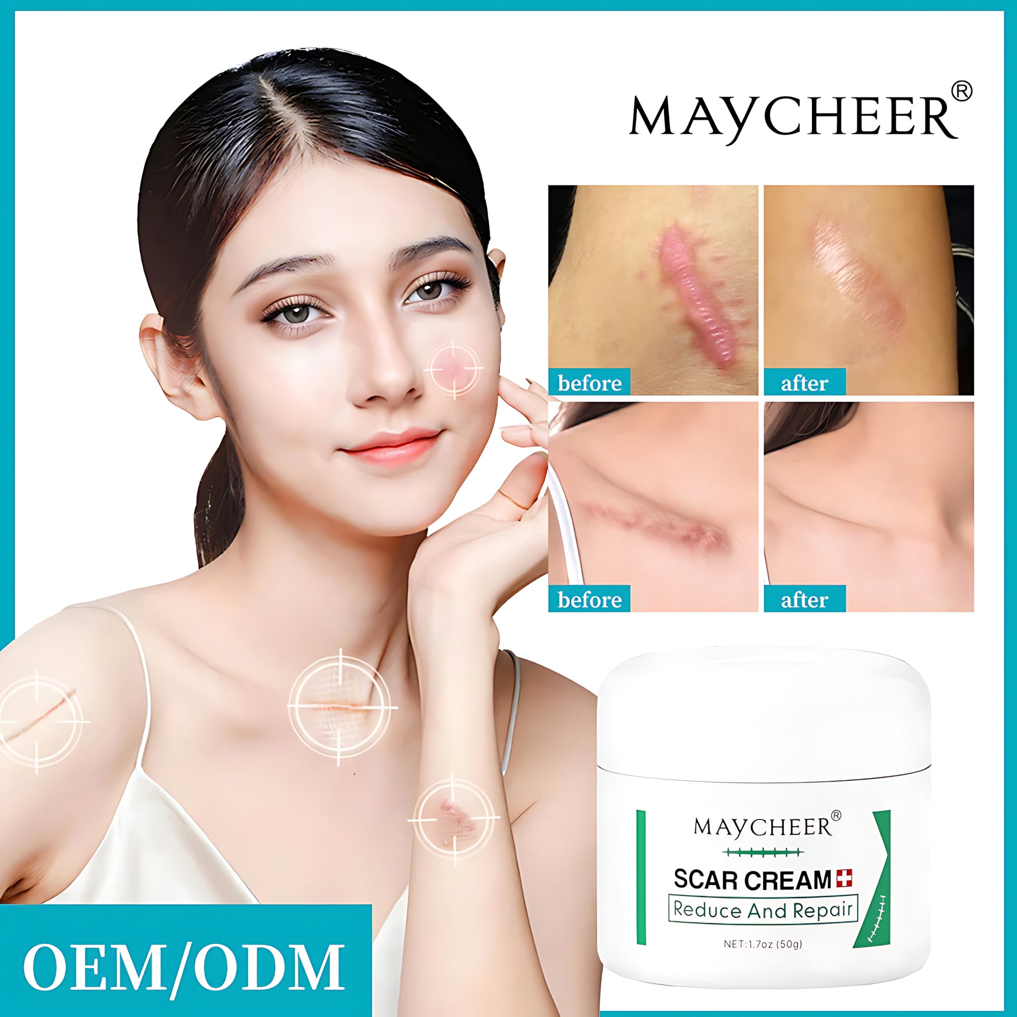 MAYCHEER Scar Cream – Advanced Scar Reduction & Skin Repair (50g)