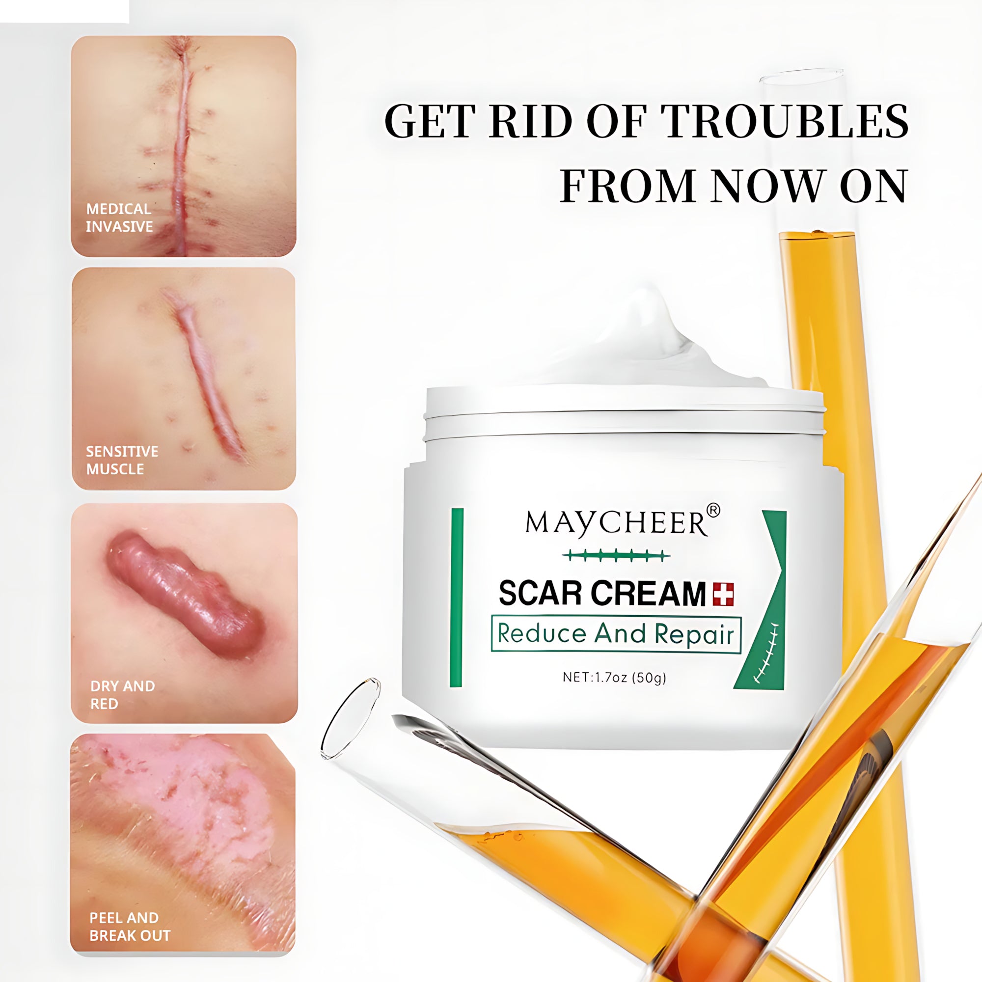 MAYCHEER Scar Cream – Advanced Scar Reduction & Skin Repair (50g)
