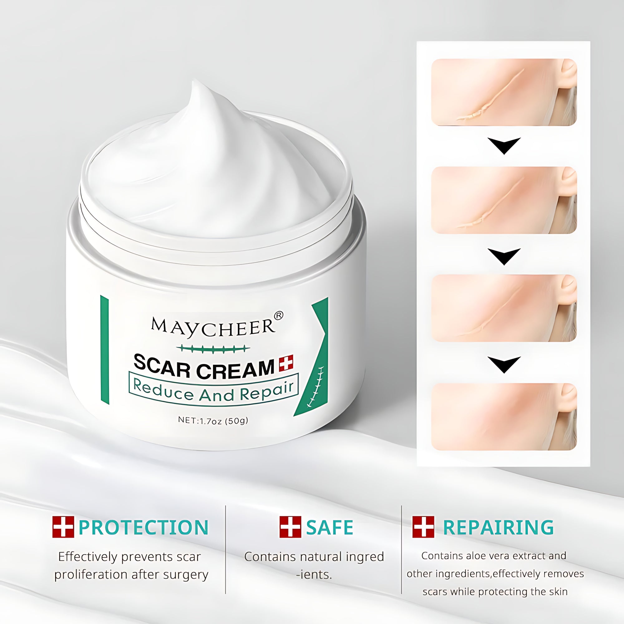 MAYCHEER Scar Cream – Advanced Scar Reduction & Skin Repair (50g)