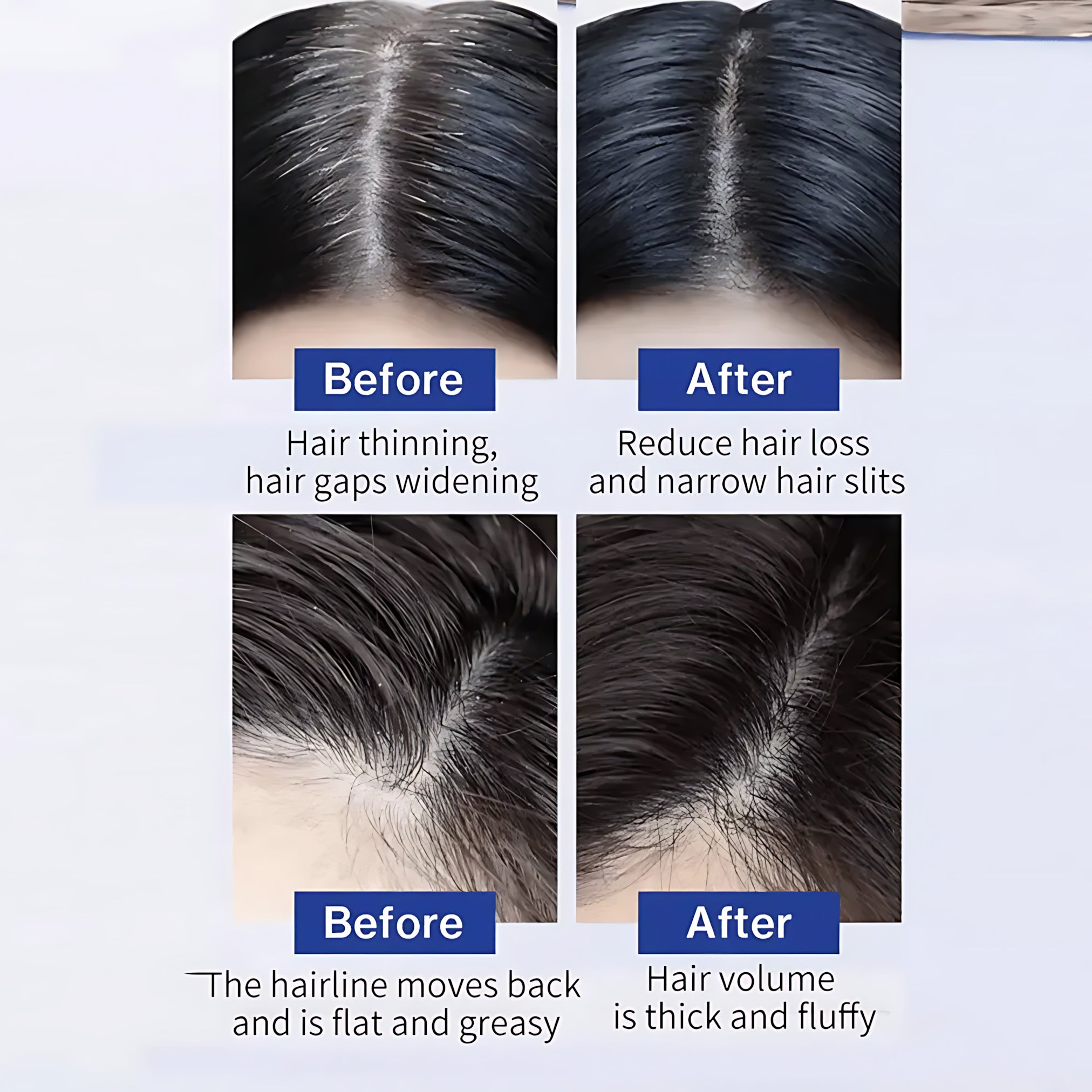 FEG Hair Growth Spray – 50ml