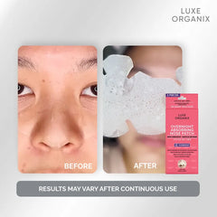 Luxe Organix Blackhead Absorbing Hydrocolloid Nose Patch (Overnight) - 7 Patches (3 + 4 FREE)